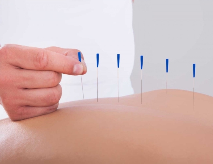 Рефлексотерапия - Оздоровительные услуги - Санаторий «Киев» Алушта